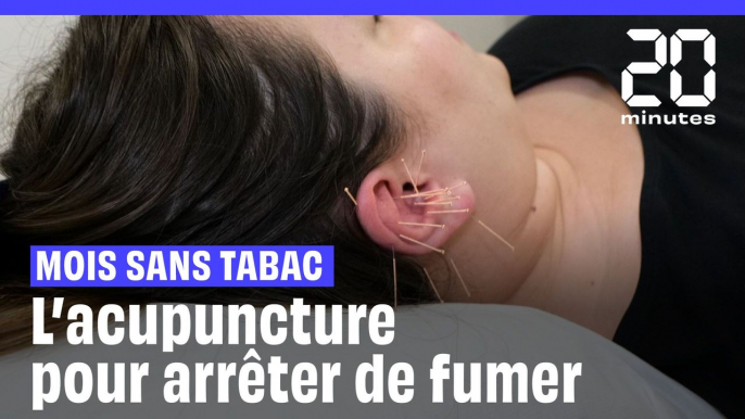 Mois sans tabac : Et si vous essayiez l'acupuncture (dans l'oreille) pour arrêter de fumer ?