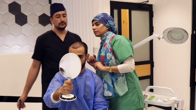 How we performed the Hair Transplant of Grade 7 baldness patient?