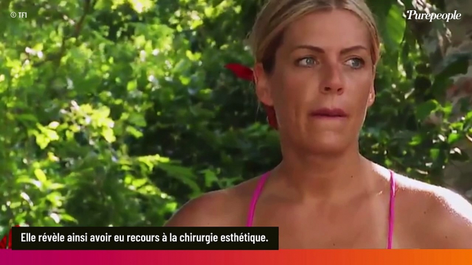 EXCLU Emilie (Koh-Lanta 2024) a cédé à la chirurgie esthétique, franches confessions de la sportive !