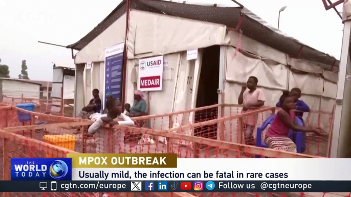 Mpox: 'Political, public health and technological solutions are needed'