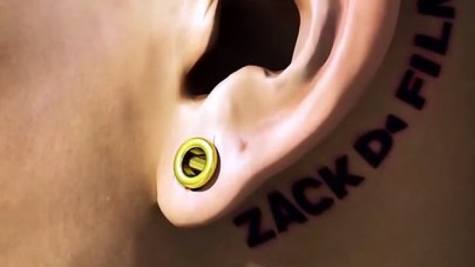 How Ear Gauges Can Tear Your Ears