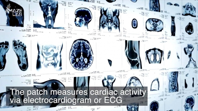 This Wearable Could One Day Detect Early Symptom of a Health Episode and Provide Early Warning