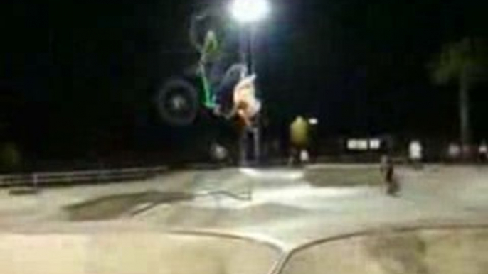 [BMX] BMX Backflip Bad Accident [Goodspeed]