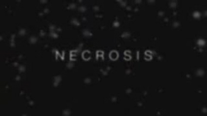 Necrosis - Trailer