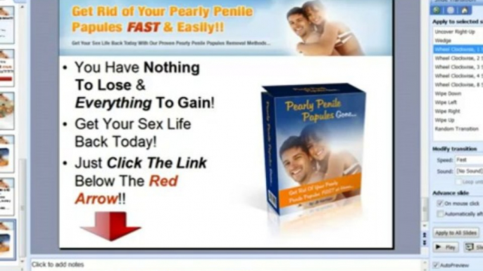 #1 Pearly Penile Papules Removal!-At Home Pearly Penile Papules Removal