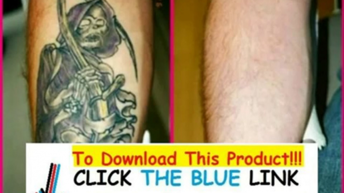 Get Rid Tattoo Naturally + Discount + Bonus