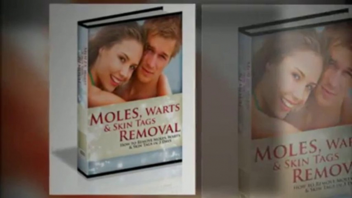 Moles Warts Skin Tags Removal - Review of Charles Davidson Moles Warts Skin Tags Removal System