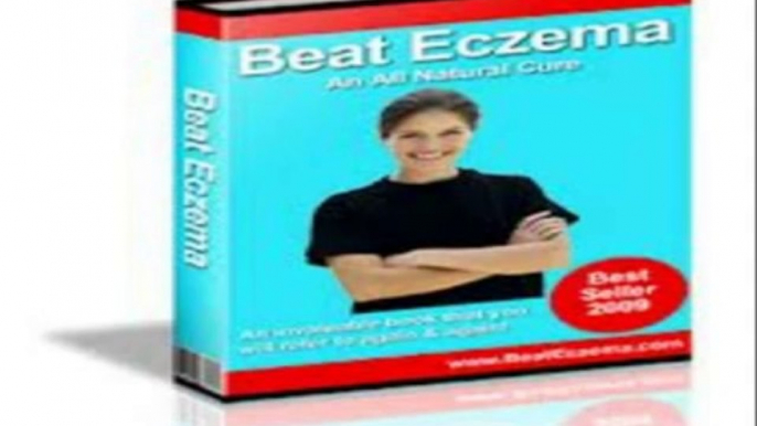 Beat Eczema now guide