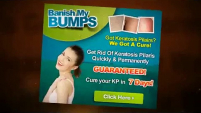 Banish My Bumps Ebook | Banish My Bumps