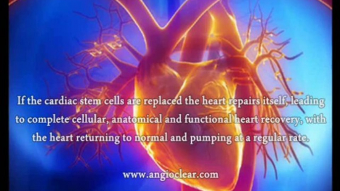 Heart Disease Treatment By Stem Cells, Does Heart Disease Treatment By Stem Cells Work