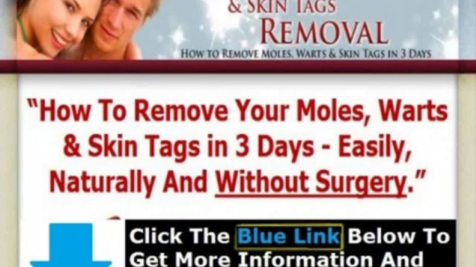 Moles Warts & Skin Tags Removal Pdf + Moles Warts Removal Review