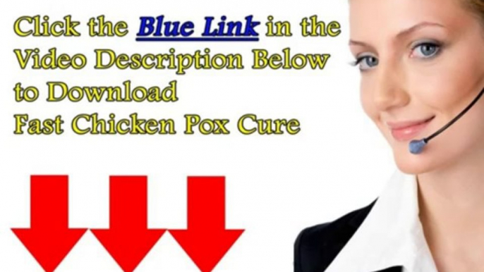 Fast Chicken Pox Cure Review +++100% Real and Honest+++