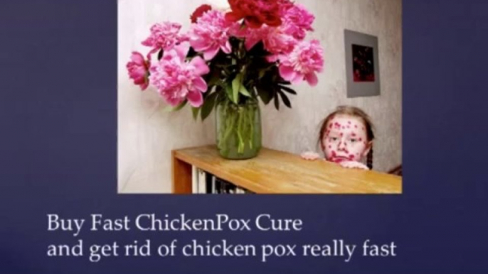 FAST CHICKEN POX CURE  ++GET SPECIAL DISCOUNT++