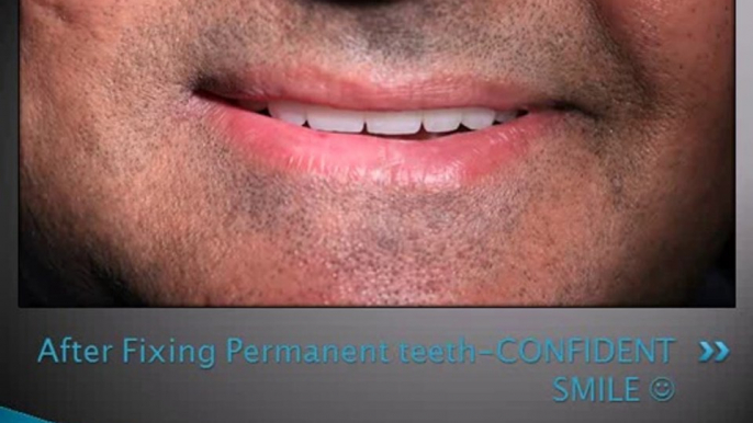 COSMETIC DENTISTRY WITH DENTAL IMPLANTS - Copy