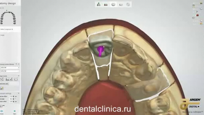 European Clinic of Aesthetic Dentistry in Budapest “Jewel Dental” “AVANTE” Dentist Medical Center Стоматология протезирование 3D моделирование, hi-tech made Lab, красивые улыбки