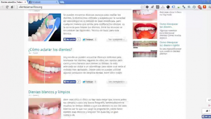 tratamiento para dientes amarillos