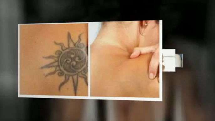 Get Rid Tattoo Naturally Reviews - Get Rid Tattoo jason carter