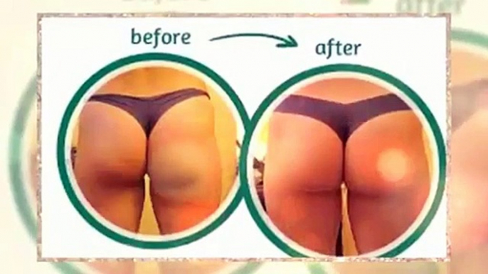 Cellulite Factor + Cellulite Factor Review