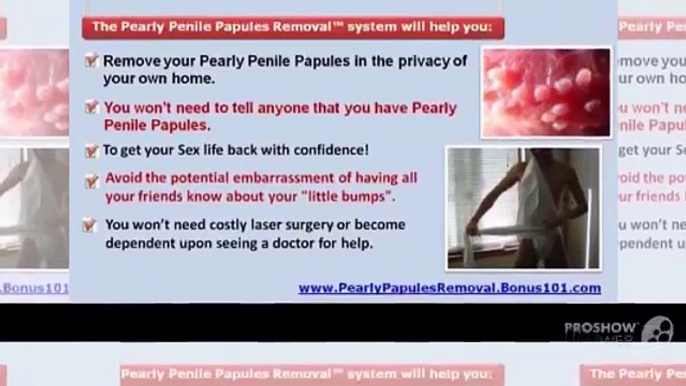 Pearly Penile Papules Removal Cost - Pearly Penile Papules Removal Home Remedy