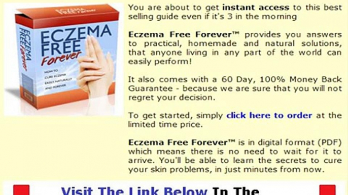 Real & Honest Eczema Free Forever Review Bonus + Discount