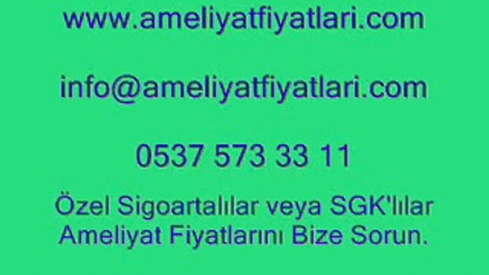 çene ameliyatı, 0537 573 33 11, çene ameliyatı fiyatları, çene ameliyatı olanlar,