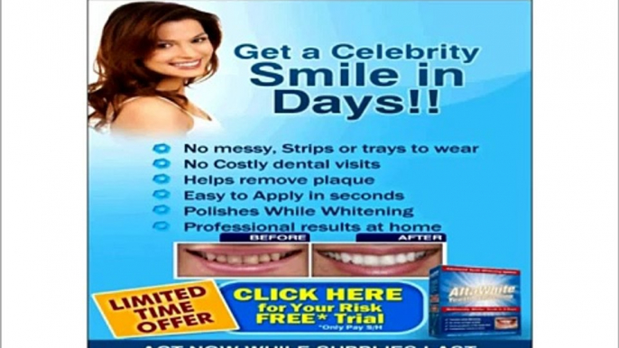 Sinsational Smile teeth whitening