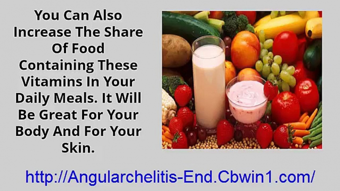 Angular Chelitis, Angular Cheilitis Pictures, Angular Cheilitis Vitamin Deficiency, Cheilitis Cause