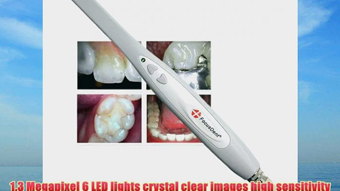 Dental Intraoral Camera - High Quality user-friendly Digital Video Imaging System for Intra