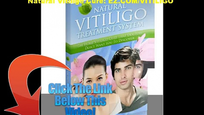 NATURAL VITILIGO TREATMENT UK