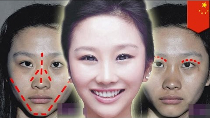 Plastic surgery before and after pictures: Double eyelid, nose job, liposuction and breast implants