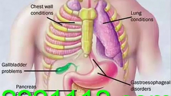 CHEST PAIN -ANGINA - اردو