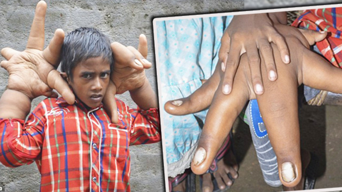 Eight Year Old Boy With HUGE HANDS!! | Shocking