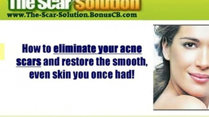 The Scar Solution - Learn the Secret of Permanent Natural Sc