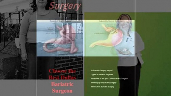 Bariatric Doctors Dallas-Bariatric Surgeons Dallas-Weight L