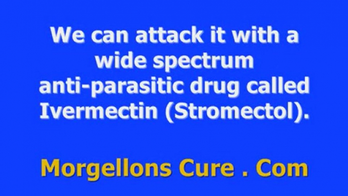 Morgellons Cure