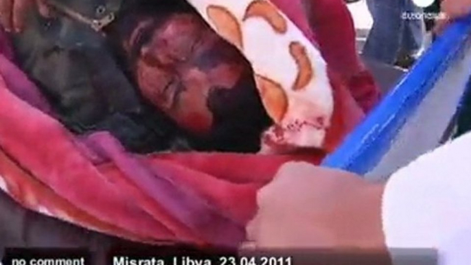 Libya: injured soldiers in Misrata are... - no comment