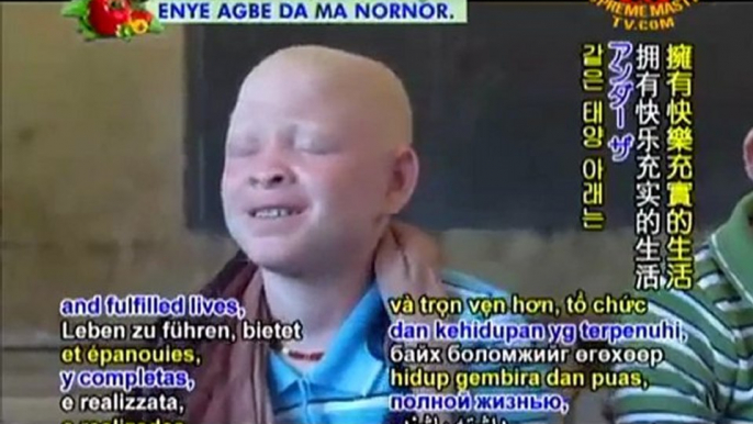 Ensuring People with Albinism Live Under The Same Sun