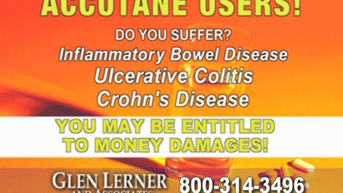 Accutane Lawyers in San Diego, (800) 314-3496 for Accutane Lawyers