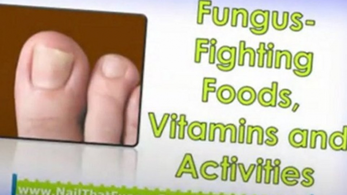 natural nail fungus treatment - cures for toenail fungus - cure for nail fungus