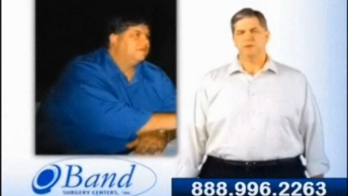 Lap Band Weight Surgery San Deigo CA