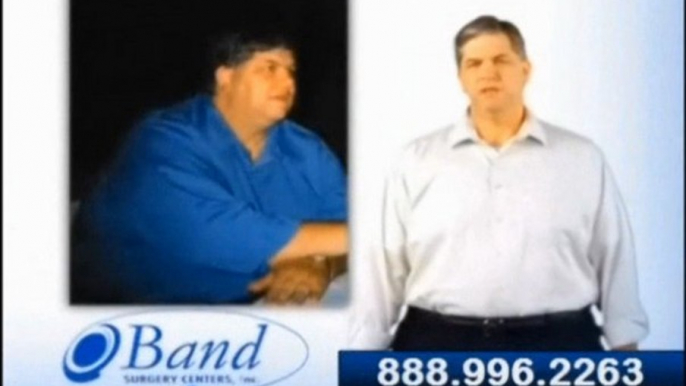 Weight Loss Surgery Band San Deigo CA