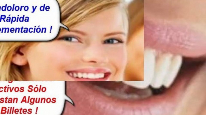 Como blanquear los dientes - como tener dientes blancos - blanqueamiento dental