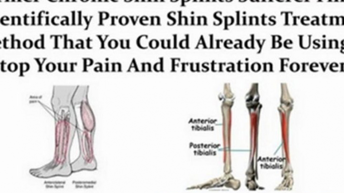 shin splints treatment - shin splints stretches - how to prevent shin splints