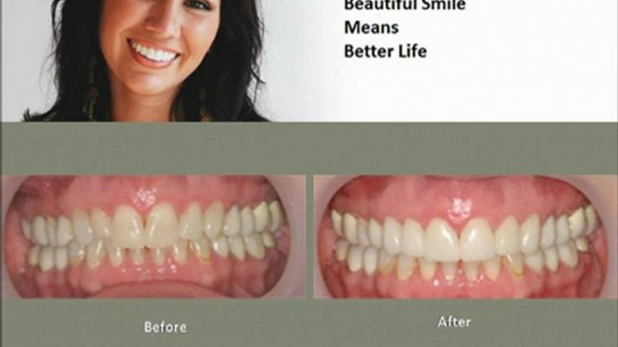 Dental Implants, Sedation & Family Dentistry in Dallas, TX