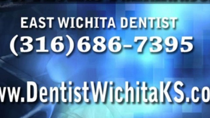 Cosmetic Dentist Wichita KS, Dental Veneer vs. Lumineer, Procelain Veneers 67206, Dentist Mcconnell, Dr. Fankhauser