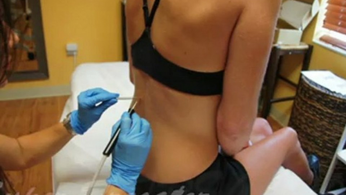 Hair Removal Boca Raton, Cellulite Reduction Boca Raton, Wrinkle Reduction Boca Raton, Thermage Skin Tightening Boca Raton