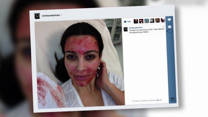 Kim Kardashian Tries Blood Facial After Kris Humphries' Family Says Their Marriage Was a Sham