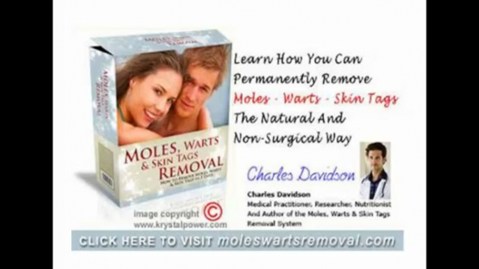 Natural Home Remedies: Home Remedies Removing Moles