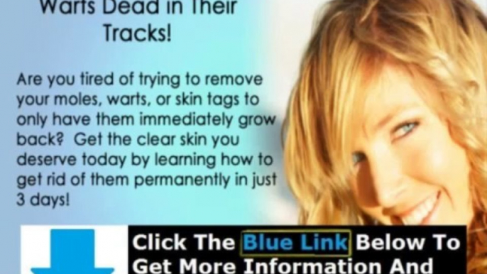 Moles Warts And Skin Tags Removal pdf + Moles Warts & Skin Tags Removal Ebook