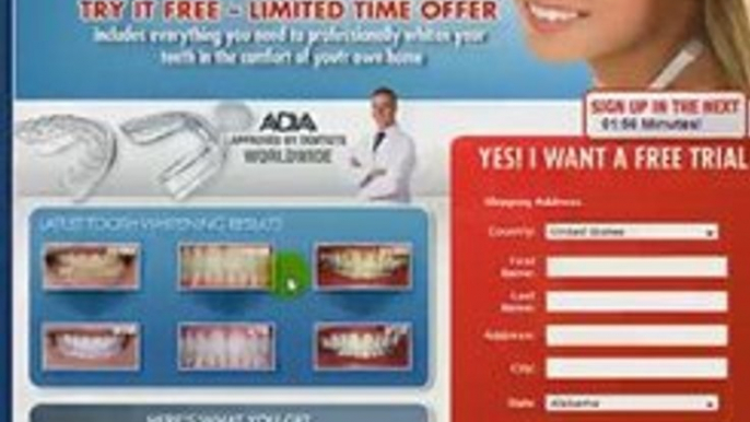 Best Teeth Whitener- The Top Product For Best Teeth Whitener